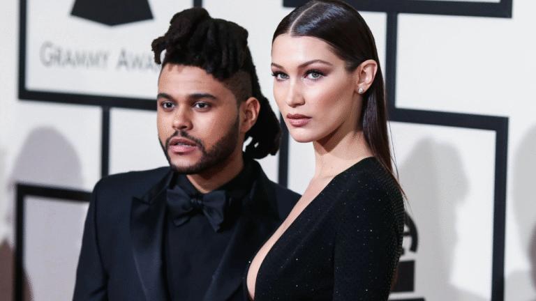 the weeknd plastic surgery